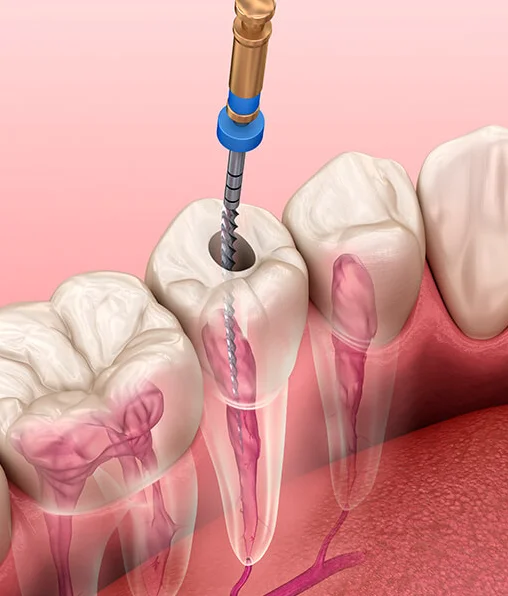 Endodontia
